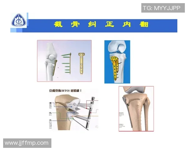 西安网球队防守策略解析深入探讨网球比赛中的防守艺术与技巧